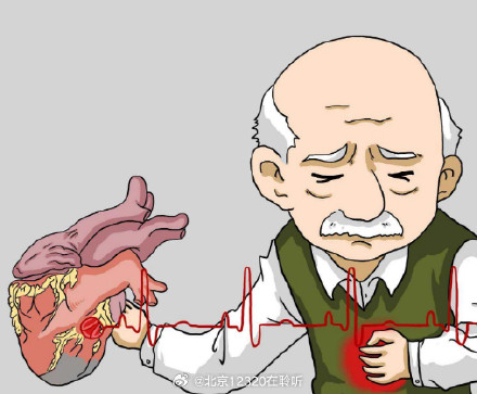 突发心血管疾病，一般有哪些症状？