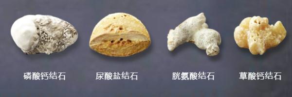 合理饮食预防泌尿结石