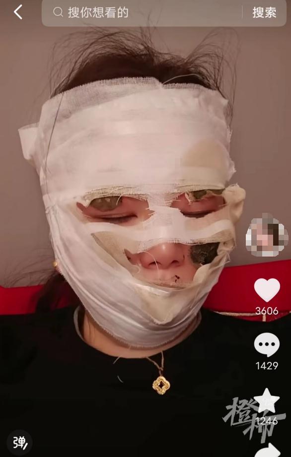 婚礼当天新娘险被毁容!这种东西要慎用 婚礼当天新娘险被毁容!这种东西要慎用