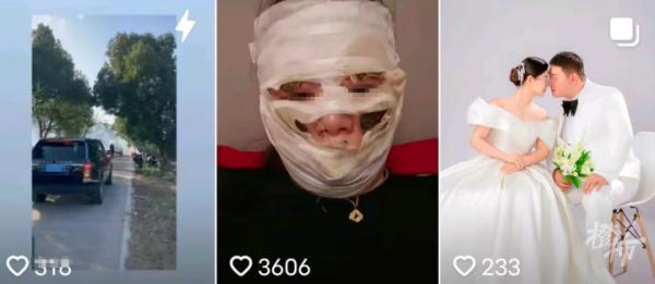 婚礼当天新娘险被毁容!这种东西要慎用 婚礼当天新娘险被毁容!这种东西要慎用