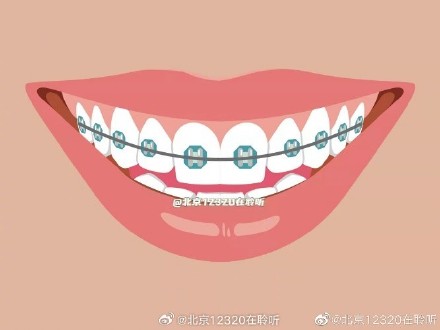 戴牙套后，日常生活有什么注意事项？