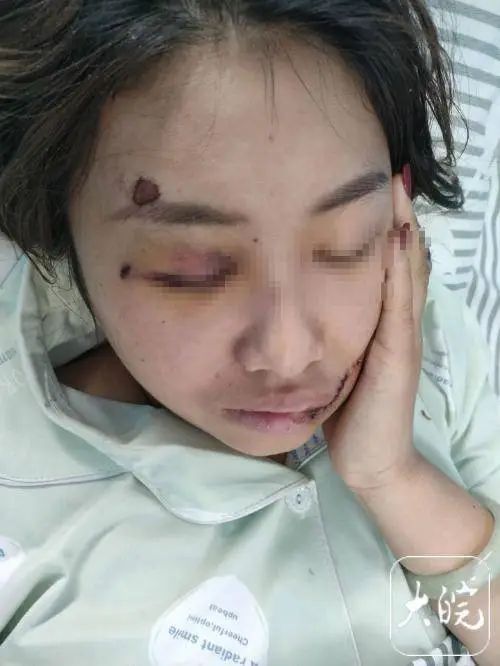 孕妇被14楼坠落的玻璃窗砸伤:为治疗无奈终止妊娠 孕妇被14楼坠落的玻璃窗砸伤:为治疗无奈终止妊娠