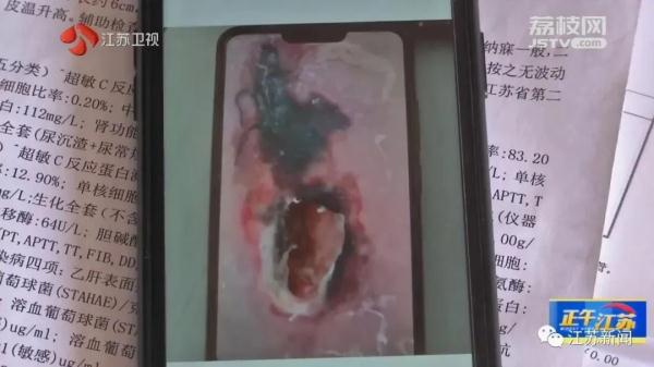 已肇事多起！野蛮冲撞、顶人咬人……前方，野猪凶猛！