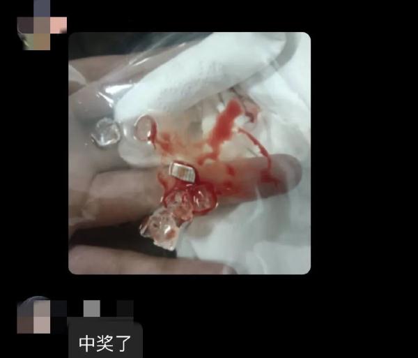 免费零食内藏刀片？口腔被划破？各方回应