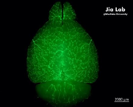 我国科学家发现神经元与血管之间新桥梁