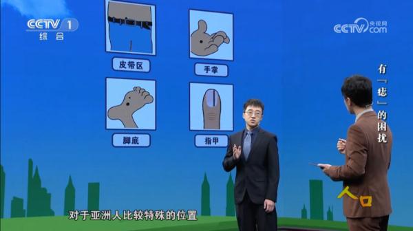 别再乱点痣了！痣出现这5种情况小心恶变，赶紧自查→