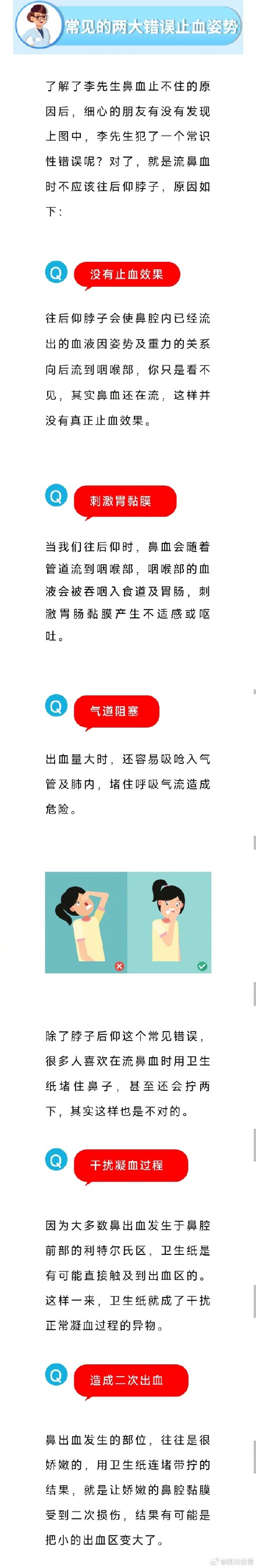 姿势错了!流鼻血不应该往后仰脖子 姿势错了!流鼻血不应该往后仰脖子