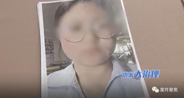 原本白净的上海小姑娘,一下点了242颗斑,成了“麻子”脸? 原本白净的上海小姑娘,一下点了242颗斑,成了“麻子”脸?