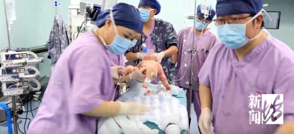 沪一2月龄婴儿特重度烧伤!在家一不小心就中招...医生紧急提醒→ 沪一2月龄婴儿特重度烧伤!在家一不小心就中招...医生紧急提醒→