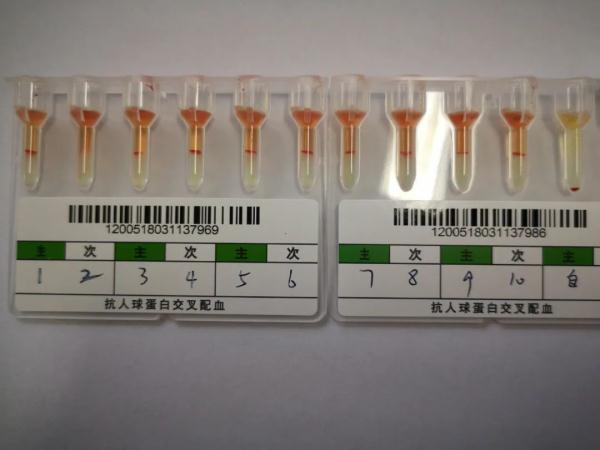 极为罕见！这里发现一例