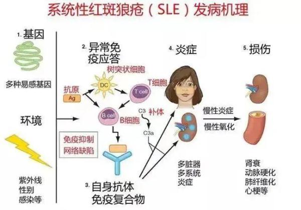 系统性红斑狼疮的日常注意事项
