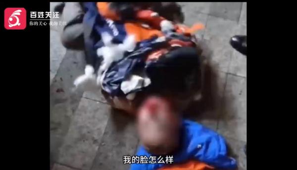 太危险！男孩往下水道塞鞭炮引爆炸，井盖炸飞、面部灼伤