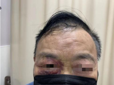 离奇!杭州大伯患怪病,一咳嗽就晕倒!很多人有这个习惯 离奇!杭州大伯患怪病,一咳嗽就晕倒!很多人有这个习惯