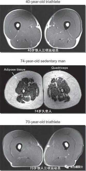 为什么能长寿的人，这个地方都很“粗”？马上测量一下