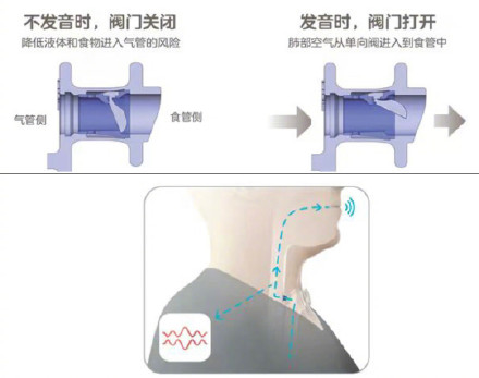 燃气安全保护设备科普知识篇——自闭阀