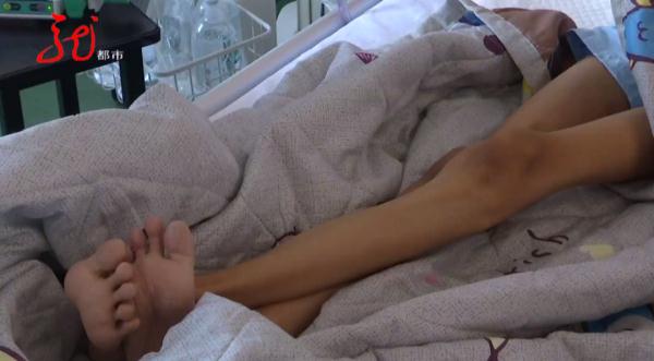 一颗肝脏，两人共享！这项手术在哈尔滨成功完成！