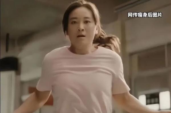 贾玲整容式暴瘦100斤！医生：减肥需科学，必要时可手术