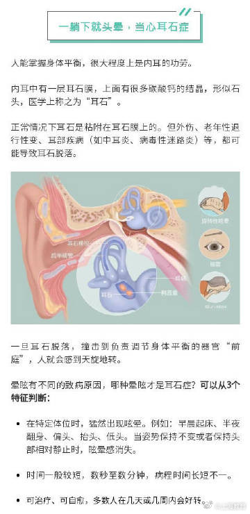 起床时头晕可能是耳石症 起床时头晕可能是耳石症