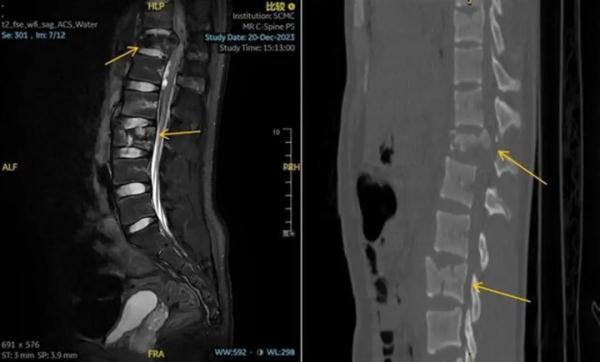 深夜,上海15岁男孩从6楼坠落!医生提醒 深夜,上海15岁男孩从6楼坠落!医生提醒