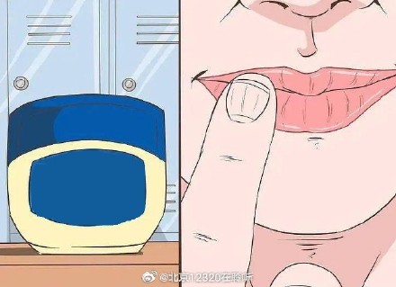 唇炎发作期间可以涂润唇膏吗? 唇炎发作期间可以涂润唇膏吗?