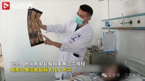 21岁女生每月来3次月经!病因竟然在大脑…… 21岁女生每月来3次月经!病因竟然在大脑……