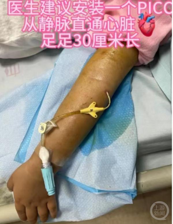 “不可能让妈妈产后再挨刀”，四川一男子捐肝救女