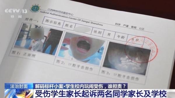 学生校内玩闹受伤，到底谁担责？从两起校园纠纷看责任划分→