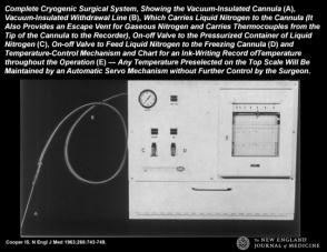 不用开刀？这种技术可以“冻死”乳腺肿瘤！