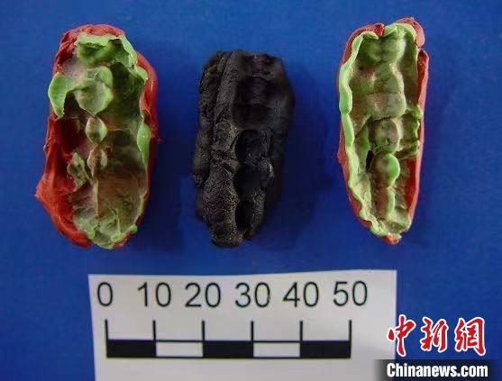 国际最新研究：一万年前“口香糖”发现采集狩猎人群或受牙病困扰