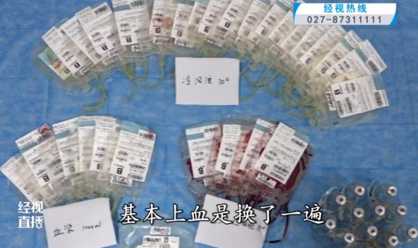 “快快快!”武汉一产妇咳嗽一声,20多名医护紧张抢救6小时...... “快快快!”武汉一产妇咳嗽一声,20多名医护紧张抢救6小时......