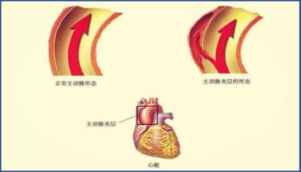 气到心裂、 抢救7小时！37岁宝妈辅导功课差点送了命