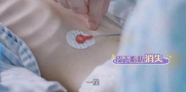 沪一厌食症女孩仅24公斤,已无法蹲下!医生吓懵:有生命危险