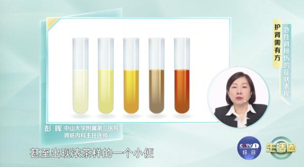 喝茶会引起急性肾损伤？真正摧毁肾的这4个行为，现在知道还不晚