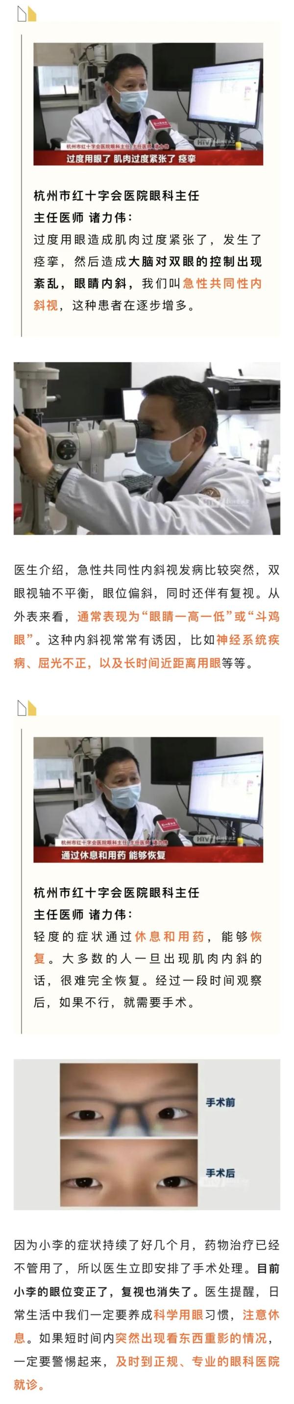 杭州14岁男孩突然变成“斗鸡眼”,这个坏习惯很多人都有 杭州14岁男孩突然变成“斗鸡眼”,这个坏习惯很多人都有