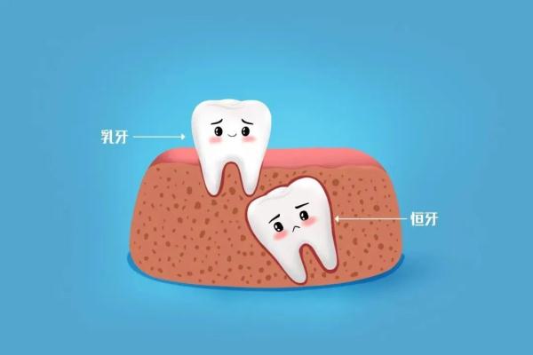 紧急！牙齿意外脱落怎么办？千万别扔，这么做还有救！(图2)