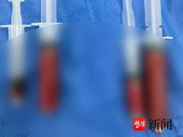 注射“胶原蛋白”后她“烂脸”了……美容变“毁容”