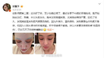 如何防止低温烫伤? 如何防止低温烫伤?