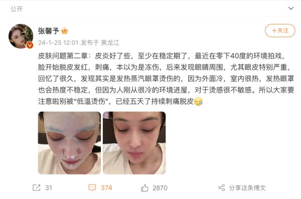 女演员自曝！不少人都曾中招