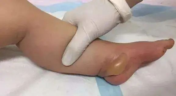 女演员自曝！不少人都曾中招