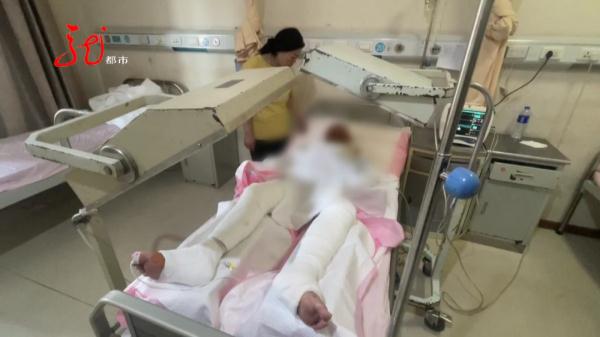 哈尔滨14岁男孩全身烧伤，妈妈痛哭：“是我没看好他！”
