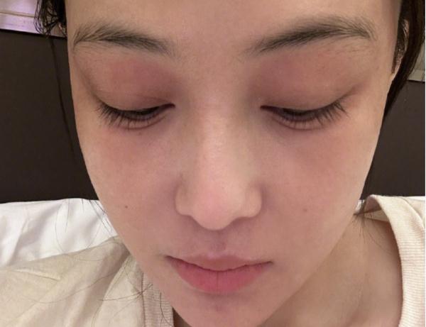 知名女演员自曝：“持续刺痛”！近期很多人中招