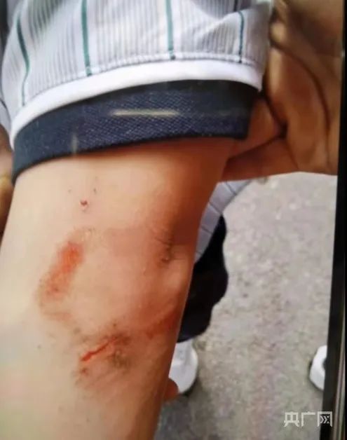 “狗咬人”有939篇裁判文书！“恶犬伤人”屡见不鲜问题到底出在哪？