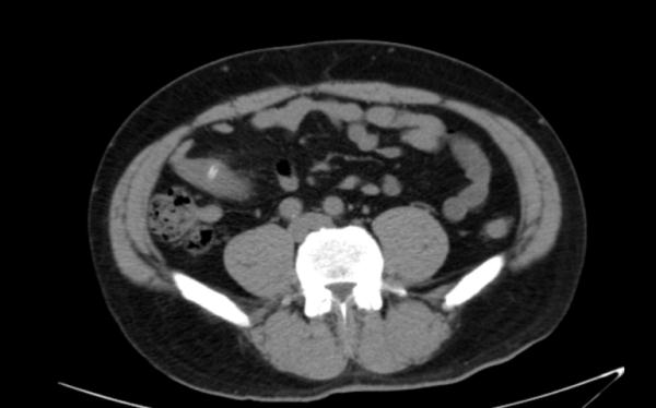 一粒枣核惹的祸 一粒枣核惹的祸