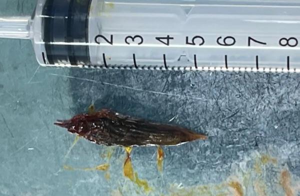 一粒枣核惹的祸 一粒枣核惹的祸