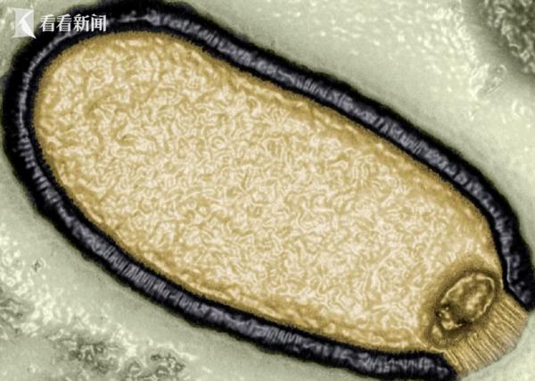 冲上热搜!科学家警告:小心北极"僵尸病毒" 冲上热搜!科学家警告:小心北极"僵尸病毒"