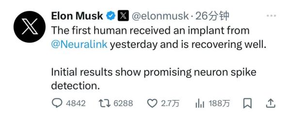 重大突破!官宣:首例人体移植完成了!或成为这些患者的福音→ 重大突破!官宣:首例人体移植完成了!或成为这些患者的福音→