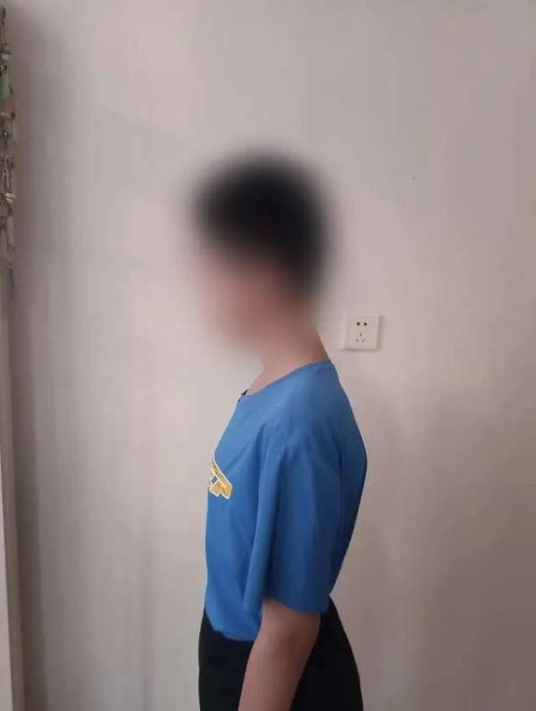 每天开塞露隔天要灌肠,巨结肠危象患儿在首儿所获新生 每天开塞露隔天要灌肠,巨结肠危象患儿在首儿所获新生