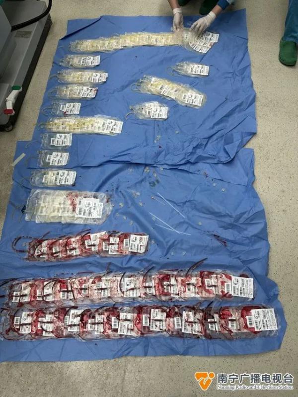 共输血3.72万毫升，相当于93人的献血量！南宁一产妇被成功救回……