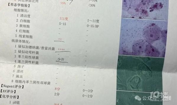 “痒到睡不着，还有灼热感！”姑娘因它直奔医院？