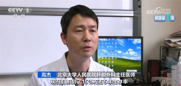 胆囊癌在我国发病率呈上升趋势 早期诊断很关键